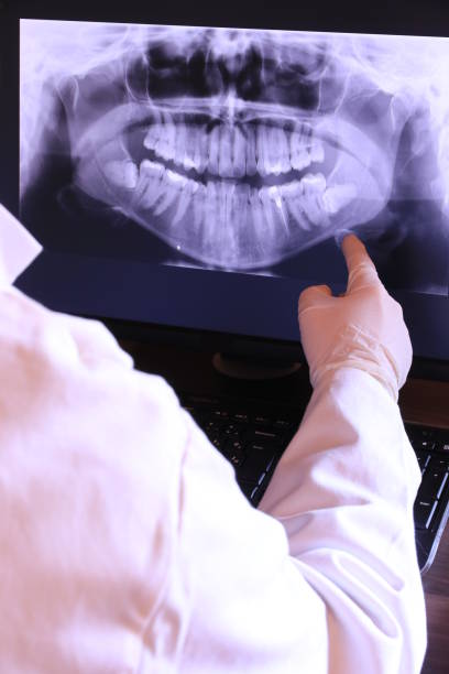 Best Emergency Dental Care for Broken or Chipped Teeth in Rkville, PA